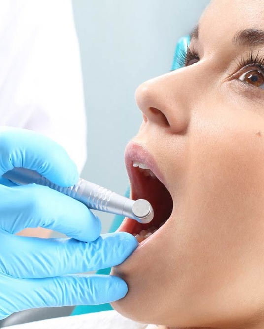 Fluoridierung & Fissurenversiegelung
