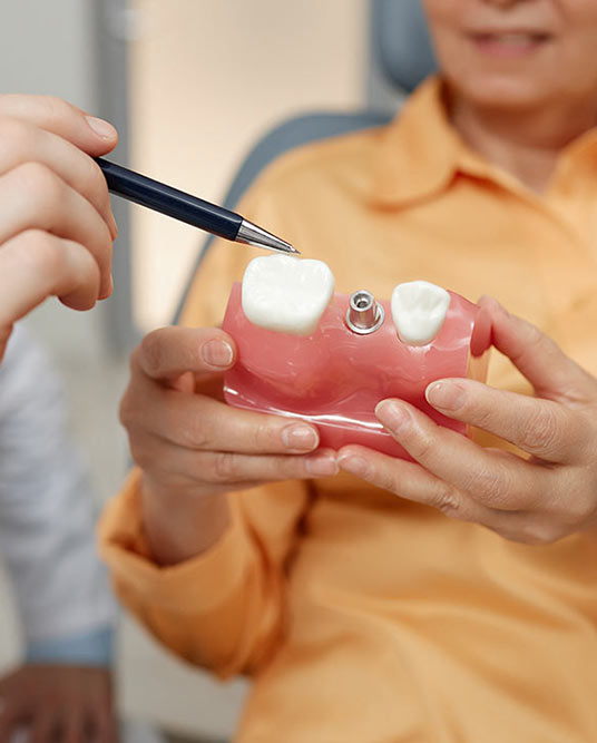Mini Implantate